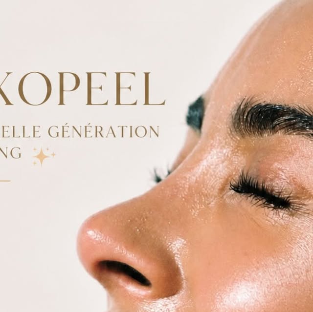 Exopeel peeling chimique profond phénol rides taches rajeunissement peau