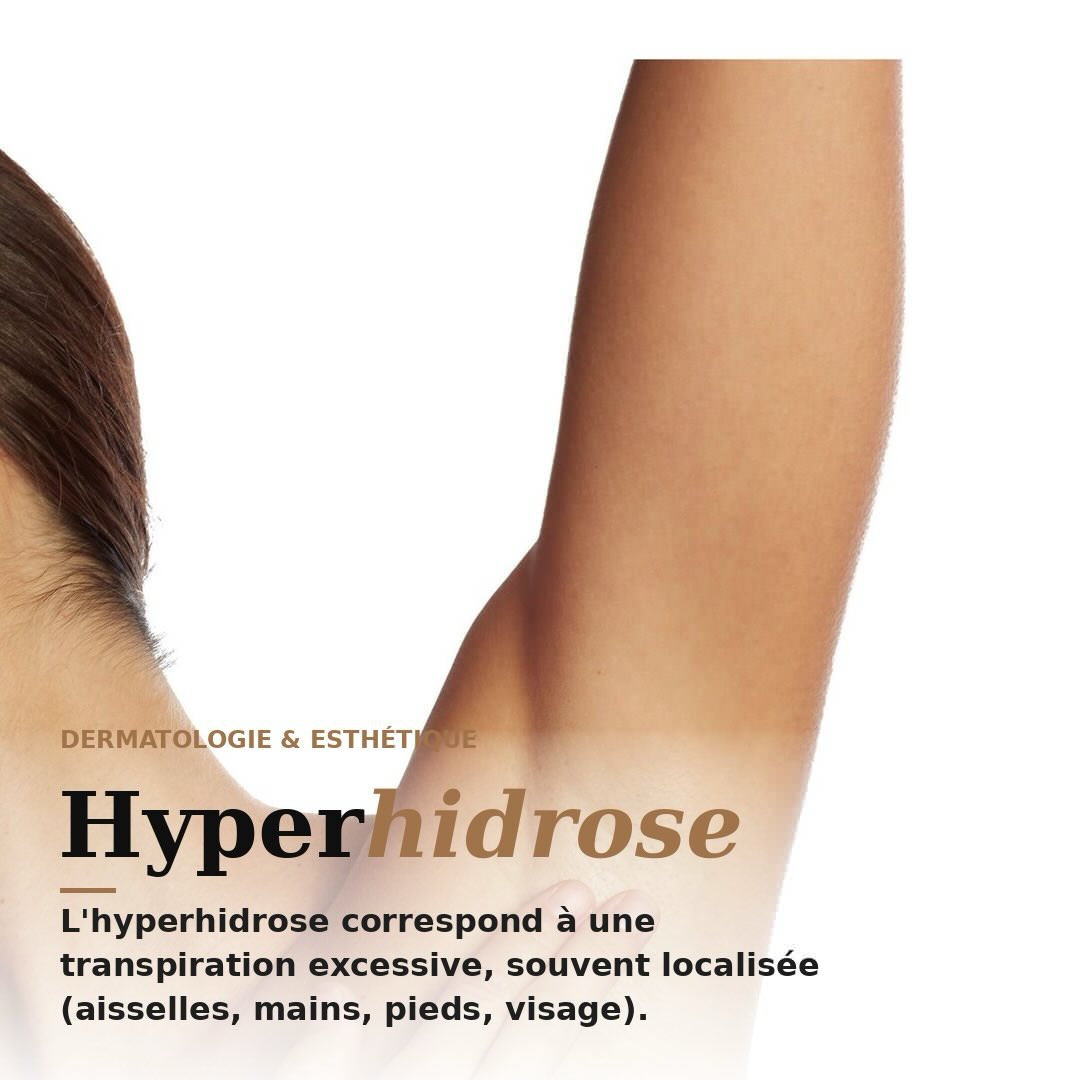 Infographie hyperhidrose : causes, zones touchées et solutions (antitranspirants, iontophorèse, Botox)