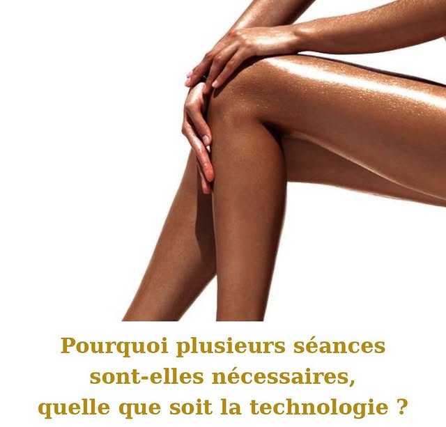 Pourquoi plusieurs séances