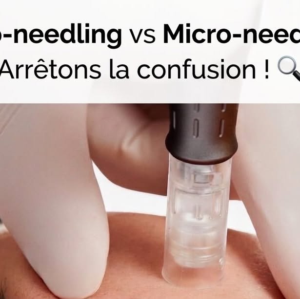 Nano needling micro needling difference peau