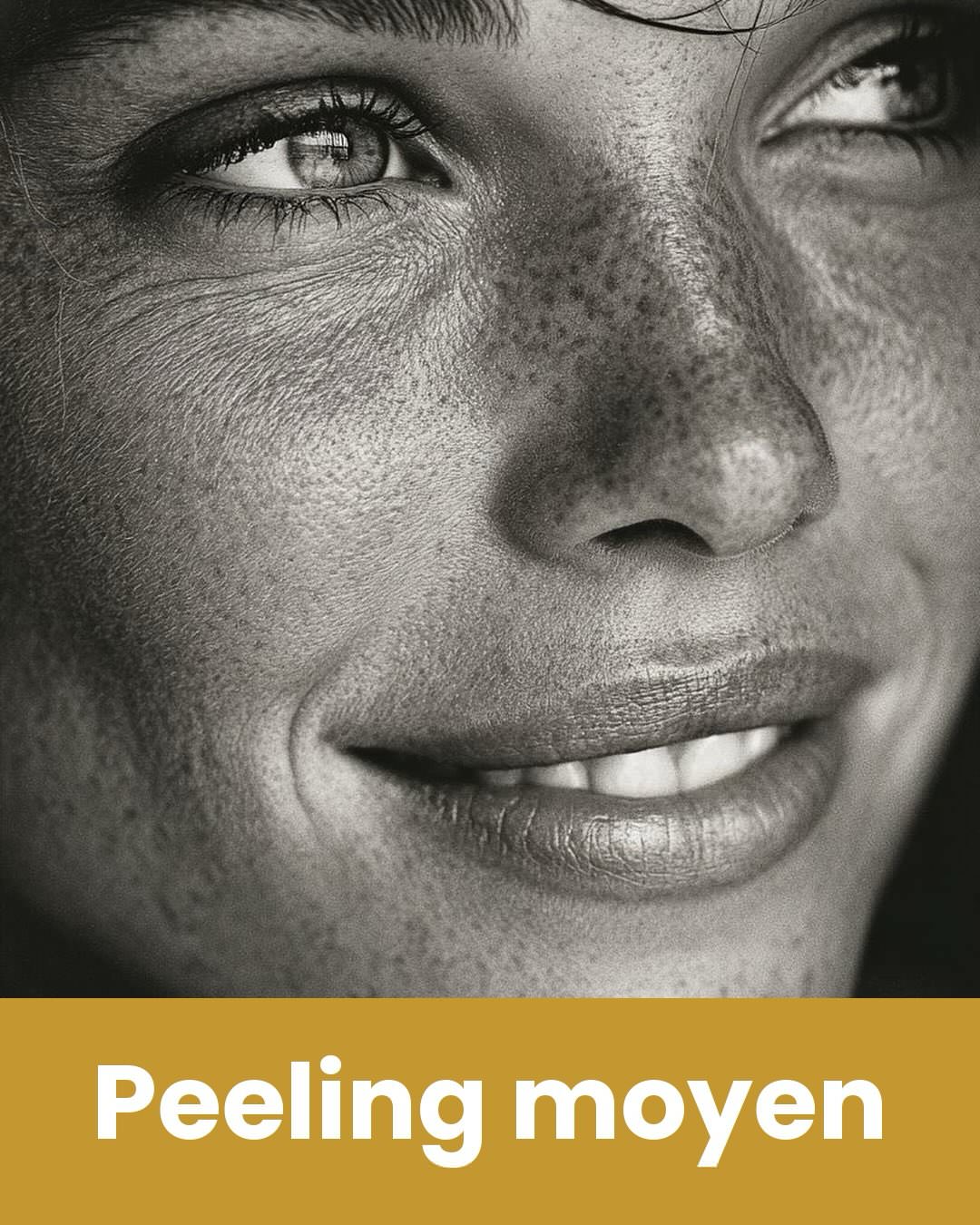 Peeling AHA/BHA superficiel — renouvellement cutané