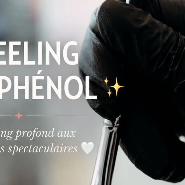Peeling profond chimique renouvellement peau