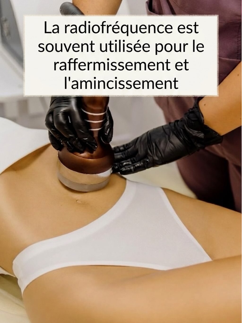 Infographie radiofréquence action sur la graisse et raffermissement de la peau