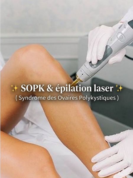 SOPK syndrome ovaires polykystiques sante femme
