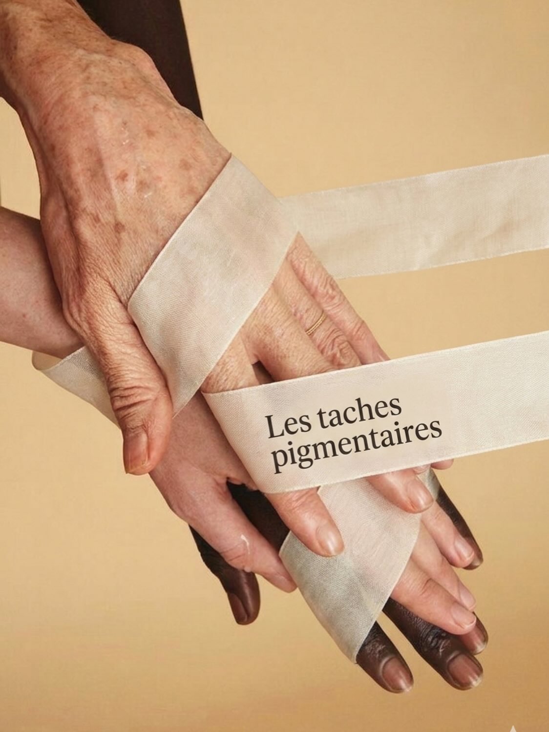 Infographie taches pigmentaires hyperpigmentation mélanine causes et traitements
